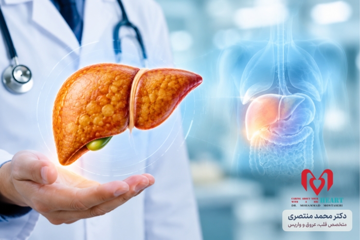 کبد چرب چیست؟ علائم، گریدها، تشخیص و درمان | دکتر محمد منتصری